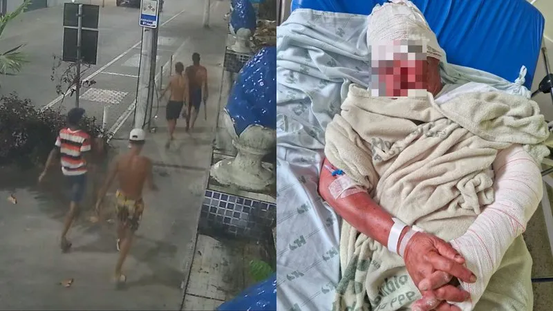 Após ser brutalmente espancado, a vítima sofreu traumatismo craniano e fraturas