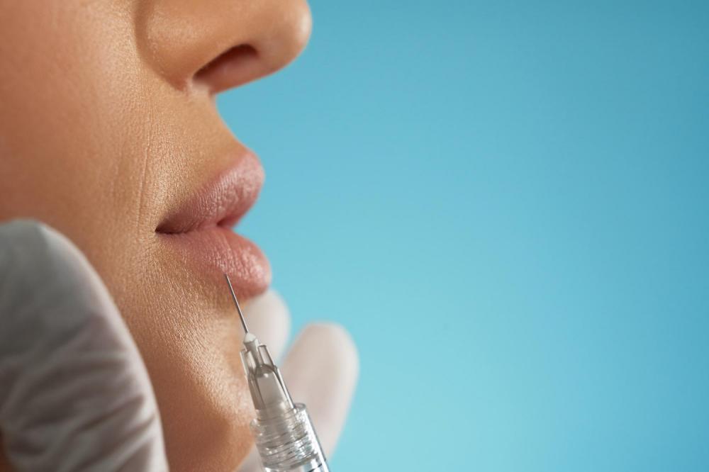 Preenchimento labial seguro: entenda mais sobre o procedimento e saiba seus benefícios