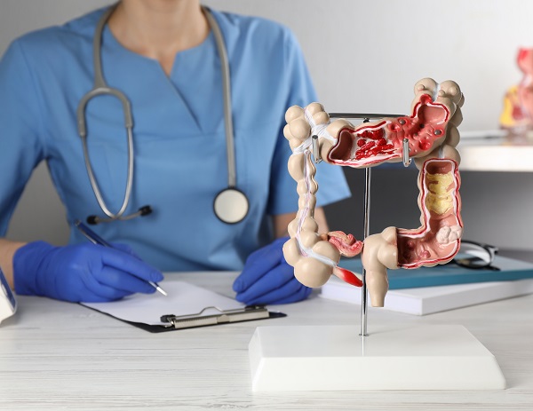 O que exatamente é saúde intestinal e por que é tão importante?
